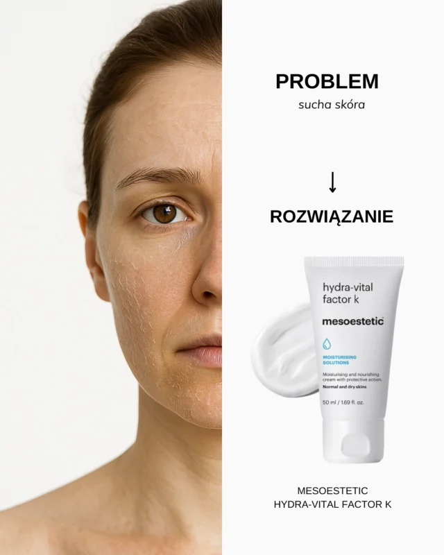 Masz problemy ze skórą? Znamy rozwiązanie!

— W naszym salonie dostępna jest profesjonalna kosmetyka, która pomoże Ci pozbyć się różnych problemów skórnych, takich jak przebarwienia, sucha skóra czy rozszerzone pory.

Pamiętaj, że połączenie pielęgnacji domowej z zabiegami kosmetologicznymi daje najlepsze efekty☝🏻

Umów się na konsultację z naszym kosmetologiem już teraz!