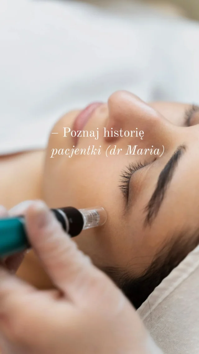 Zapraszamy na wizyty do dr Marii👩🏼‍⚕️

Wśród dostępnych zabiegów są:

– stymulatory tkankowe
– toksyna botulinowa
– mezoterapia
– modelowanie ust
– wolumetria twarzy
– konsultacja

Doktor Maria pracuje w oparciu o najnowsze standardy i indywidualne podejście do każdego klienta✔️