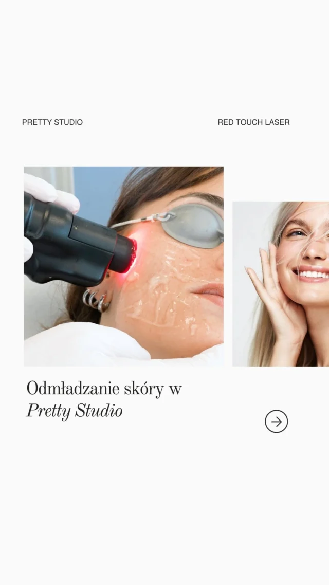 Twoja skóra traci jędrność, wygląda na zmęczoną, a makijaż przestaje maskować oznaki zmęczenia? 

— Red Touch to innowacyjny laser, który jako pierwszy działa bezpiecznie na kolagen typu I – ten, który odpowiada za młody wygląd skóry. Zabieg stymuluje regenerację od wewnątrz, bez naruszania naskórka, bez bólu i bez okresu rekonwalescencji✔️

Skóra po serii zabiegów staje się jędrniejsza, gładsza, promienna i zdecydowanie młodsza. Dla kobiet, które chcą wyglądać świeżo i naturalnie – bez skalpela i bez przesady☝🏻

Skorzystaj z 15% ZNIŻKI na zabieg – tylko do końca miesiąca!